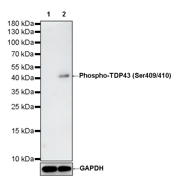 Phospho-TDP43 (Ser409/410) Recombinant Rabbit mAb