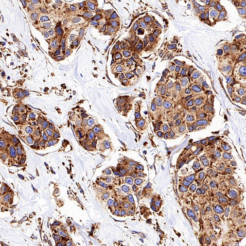 SERCA2 ATPase Recombinant Rabbit mAb (S-5956)