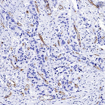 PODXL Recombinant Rabbit mAb (S-2014-9)