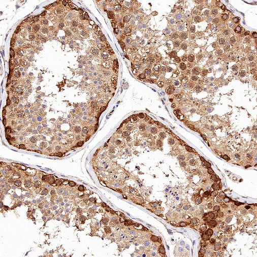 IMPDH2 Rabbit Polyclonal Antibody