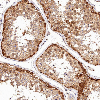 IMPDH2 Rabbit Polyclonal Antibody