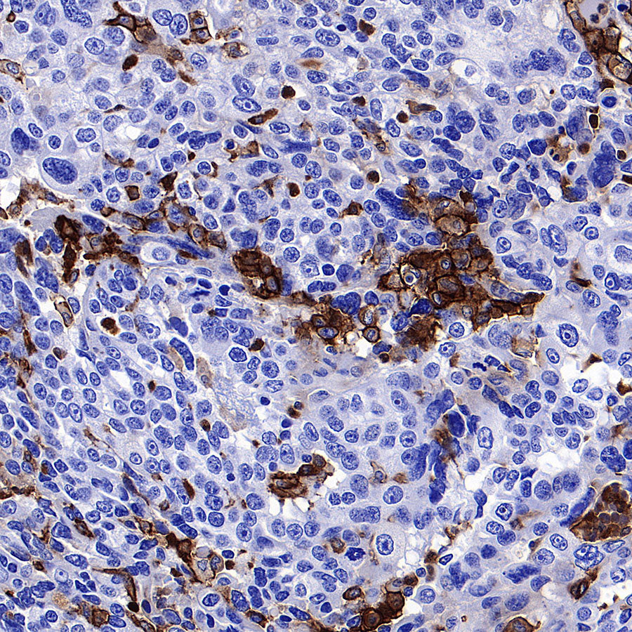 uPAR/CD87 Recombinant Rabbit mAb (S-3960-82)