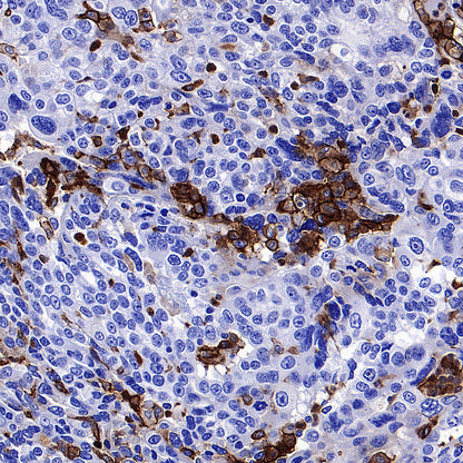uPAR/CD87 Recombinant Rabbit mAb (S-3960-82)