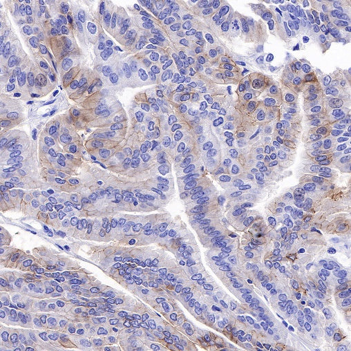 ROR1 Recombinant Rabbit mAb (SDT-R502-2)