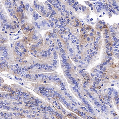 ROR1 Recombinant Rabbit mAb (SDT-R502-2)