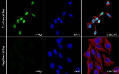 N-Myc Recombinant Rabbit mAb (S-2729-50)