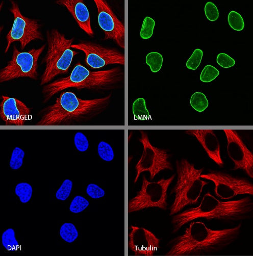 Lamin A Recombinant Rabbit mAb (S-1503-44)
