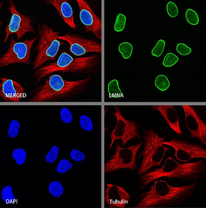Lamin A Recombinant Rabbit mAb (S-1503-44)