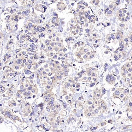 Rictor Recombinant Rabbit mAb (S-2601-26)