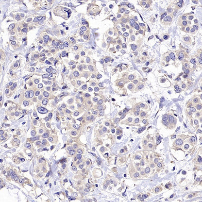 Rictor Recombinant Rabbit mAb (S-2601-26)