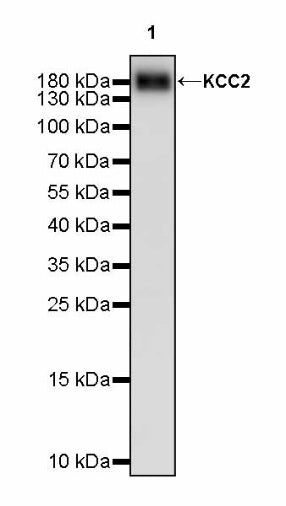 KCC2 Recombinant Rabbit mAb (S-3044-2)