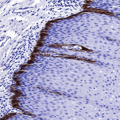 Collagen XVII Recombinant Rabbit mAb (S-1636-5)