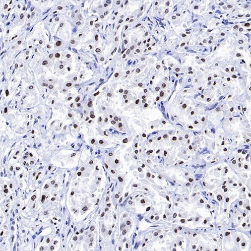 Histone H4 (Lactyl K5) Recombinant Rabbit mAb (S-3220-73)