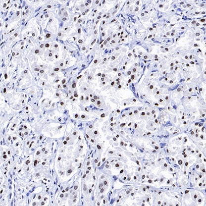 Histone H4 (Lactyl K5) Recombinant Rabbit mAb (S-3220-73)