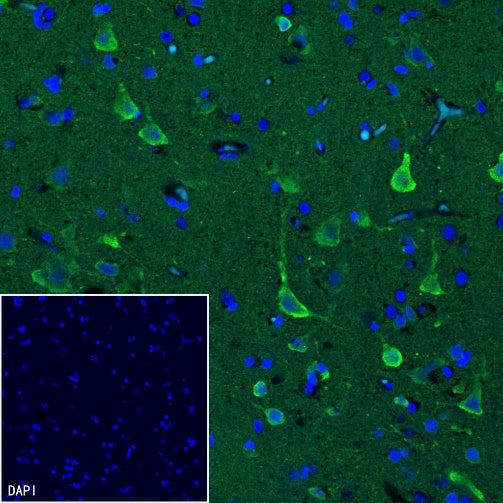NRGN Recombinant Rabbit mAb (S-1624-60)