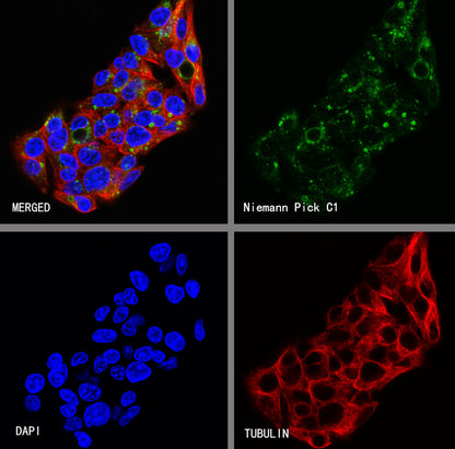 Niemann Pick C1 Recombinant Rabbit mAb (S-5243)