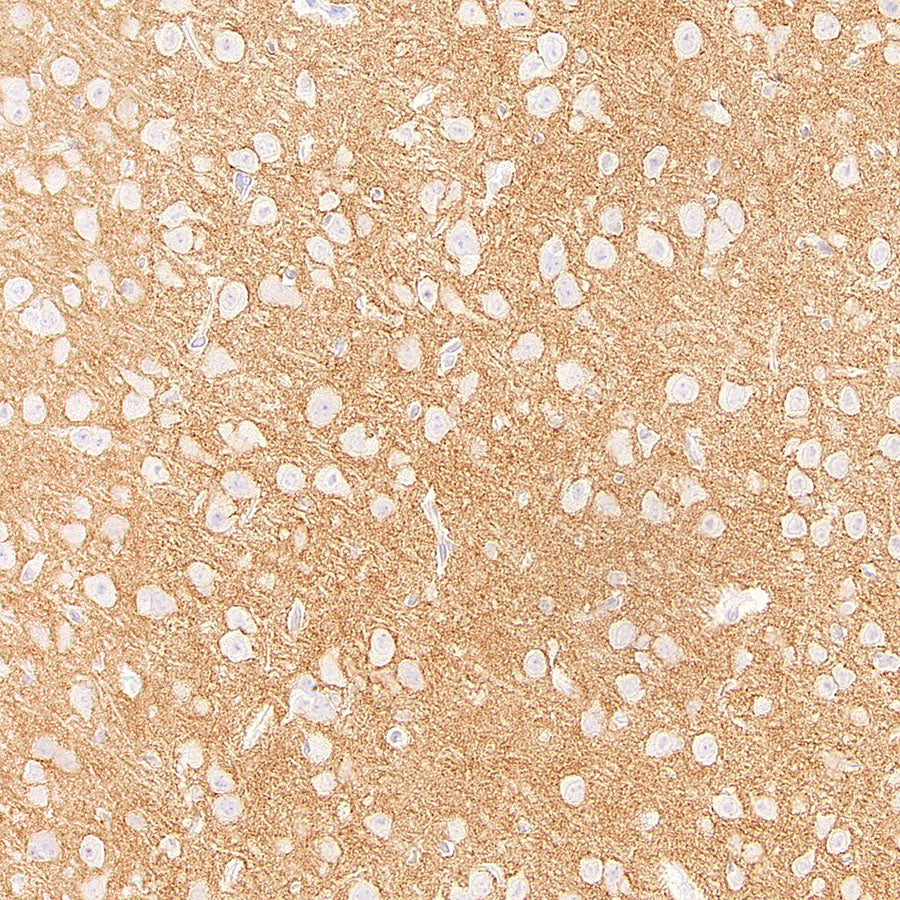 ADAM22 Recombinant Rabbit mAb (S-3201-8)