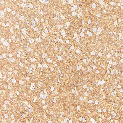 ADAM22 Recombinant Rabbit mAb (S-3201-8)