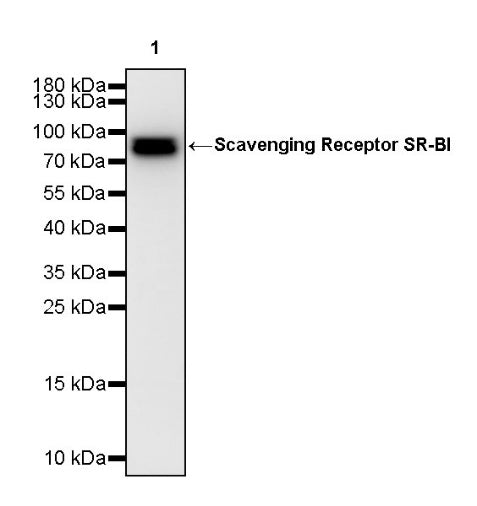 Scavenging Receptor SR-BI Recombinant Rabbit mAb (S-1736-15)