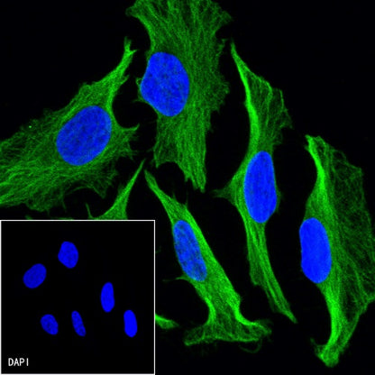 α-tubulin Recombinant Mouse mAb (S-364-23HL)