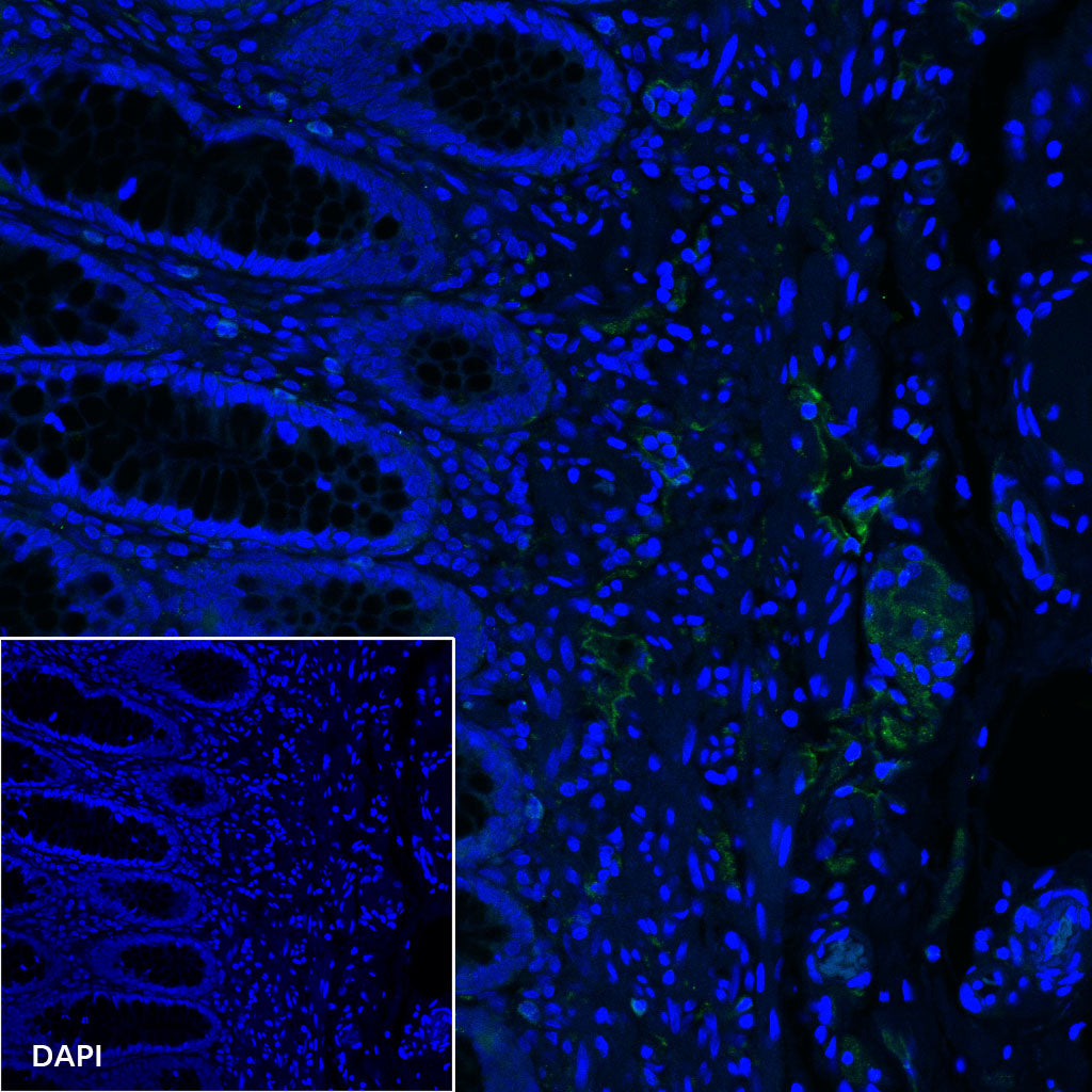 Podoplanin (D2-40) Recombinant Rabbit mAb,PBS Only (SDT-1178-8)