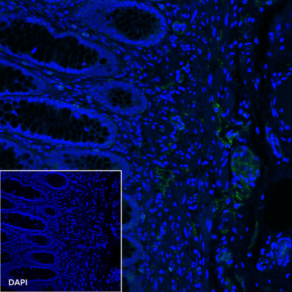 Podoplanin (D2-40) Recombinant Rabbit mAb,PBS Only (SDT-1178-8)