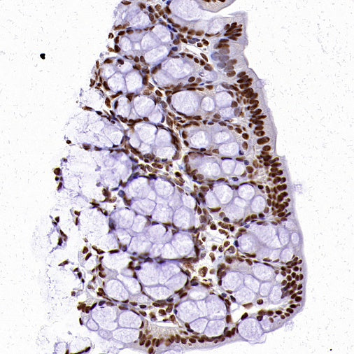 Histone H3 (tri methyl K4) Recombinant Rabbit mAb (S-1602-21)