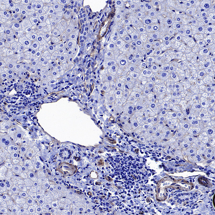 CD151 Recombinant Rabbit mAb (S-3235-104)