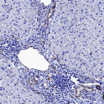 CD151 Recombinant Rabbit mAb (S-3235-104)