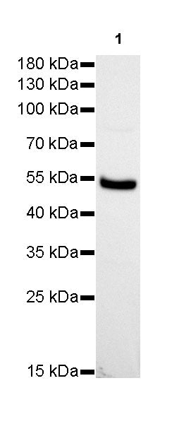 GLUT2 Recombinant Rabbit mAb (SDT-R036)