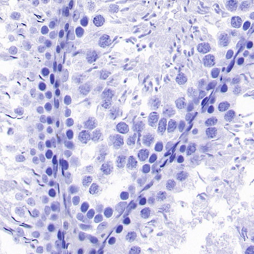 Vesicular Glutamate Transporter 1 (VGLUT1) Recombinant Rabbit mAb (S-1118-58)