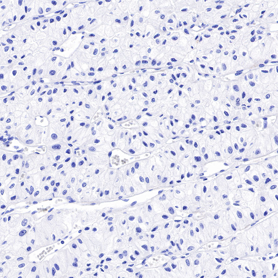 S-RMab® p53 Recombinant Rabbit mAb (SDT-R118)