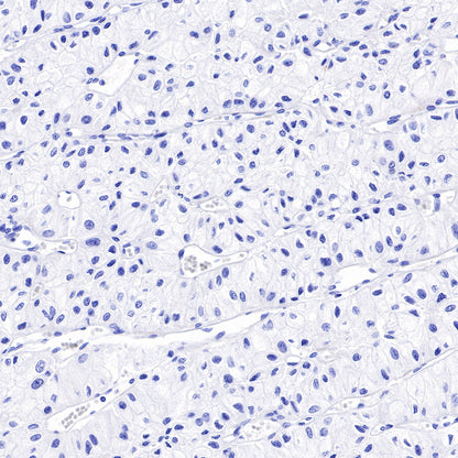 S-RMab® p53 Recombinant Rabbit mAb (SDT-R118)