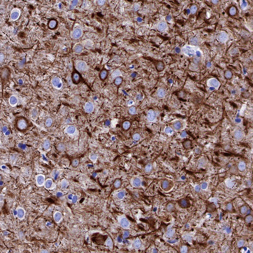 Neurofilament H Recombinant Rabbit mAb (S-532-103)