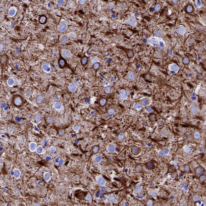 Neurofilament H Recombinant Rabbit mAb (S-532-103)