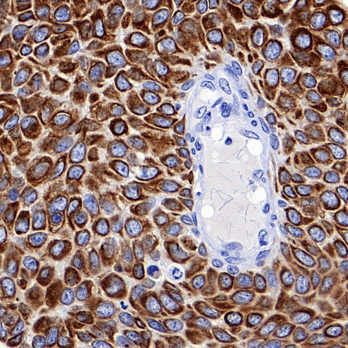 Keratin 16 Recombinant Rabbit mAb (S-R306)