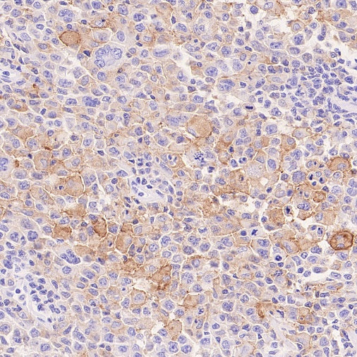 LILRB4 Recombinant Rabbit mAb (S-2504-22)