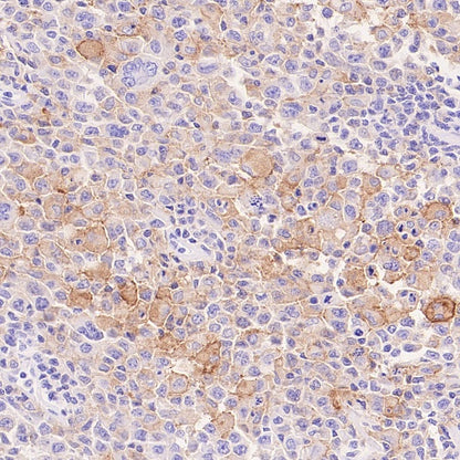 LILRB4 Recombinant Rabbit mAb (S-2504-22)