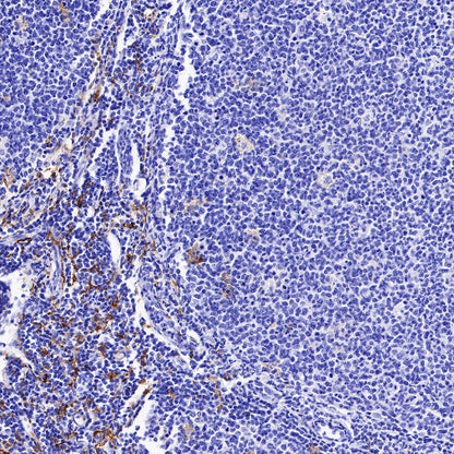 CD163 Recombinant Rabbit mAb (SDT-222-171)
