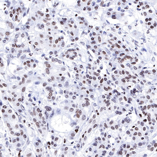 Propionyl-Histone H4 (Lys5) Recombinant Rabbit mAb (S-R093)