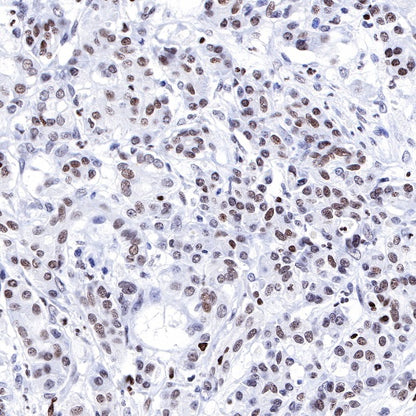 Propionyl-Histone H4 (Lys5) Recombinant Rabbit mAb (S-R093)