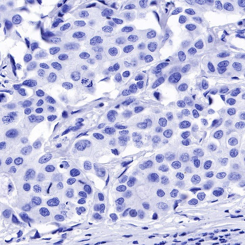 MUC2 Recombinant Rabbit mAb (SDT-345-9)