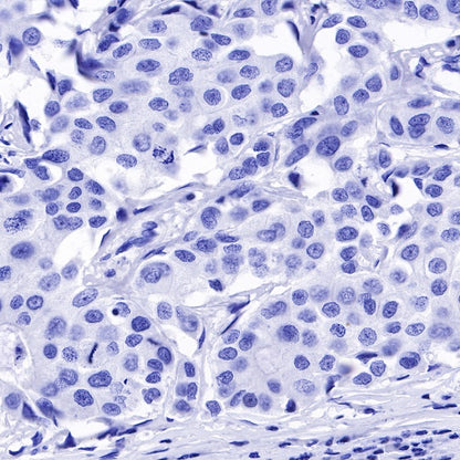 MUC2 Recombinant Rabbit mAb (SDT-345-9)