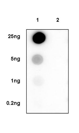 Phospho-TGF β Receptor I(Ser165) Recombinant Rabbit mAb (S-1896-21)