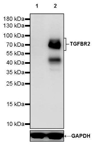 TGFBR2 Recombinant Rabbit mAb (S-1711-55)