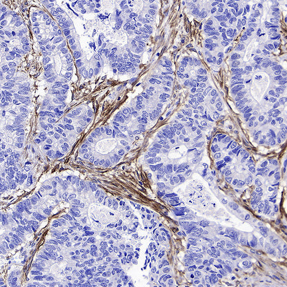 Fibroblast Activation Protein alpha/FAP Recombinant Rabbit mAb (S-3998-2)