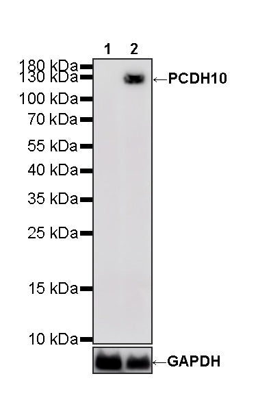PCDH10 Recombinant Rabbit mAb (S-4531-4)