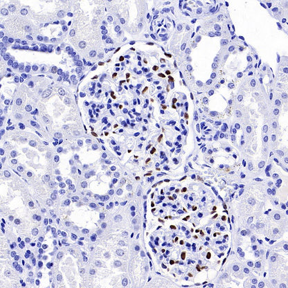 Wilms Tumor Protein (WT1) Recombinant Rabbit mAb (SDT-2864)