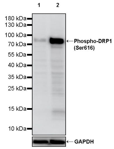 Phospho-DRP1 (Ser616) Recombinant Rabbit mAb (S-1281-375)