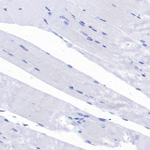 CBS Rabbit Polyclonal Antibody